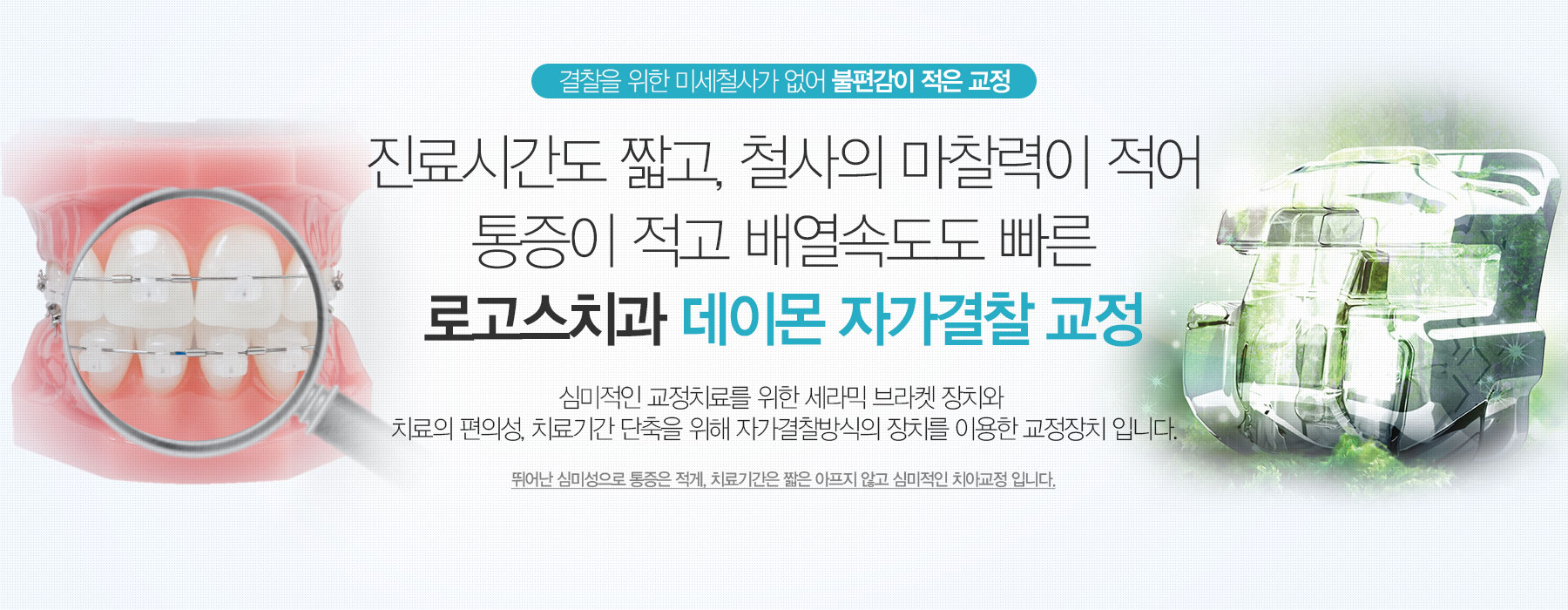 진료시간도 짧고, 철사의 마찰력이 적어 통증이 적고 배열속도도 빠른 로고스치과 데이몬 자가결찰 교정